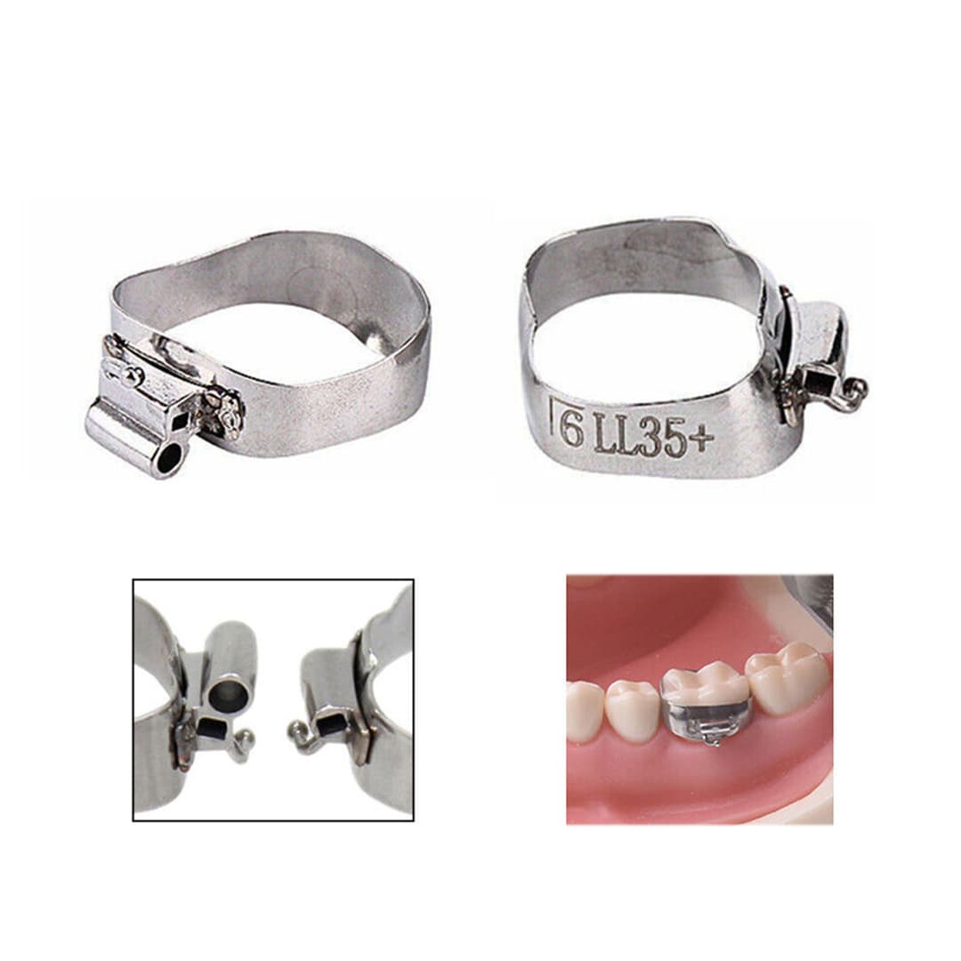 1ST MOLAR PREWELDED -MBT 0.022- U2/L1 MOLAR BANDS (PACK OF 4)