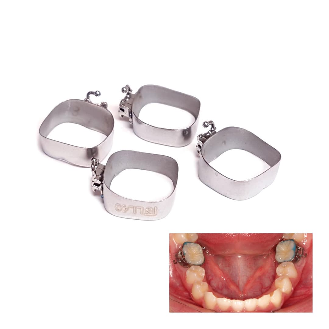 1ST MOLAR PREWELDED -MBT 0.018- U2/L1 MOLAR BANDS (PACK OF 4)