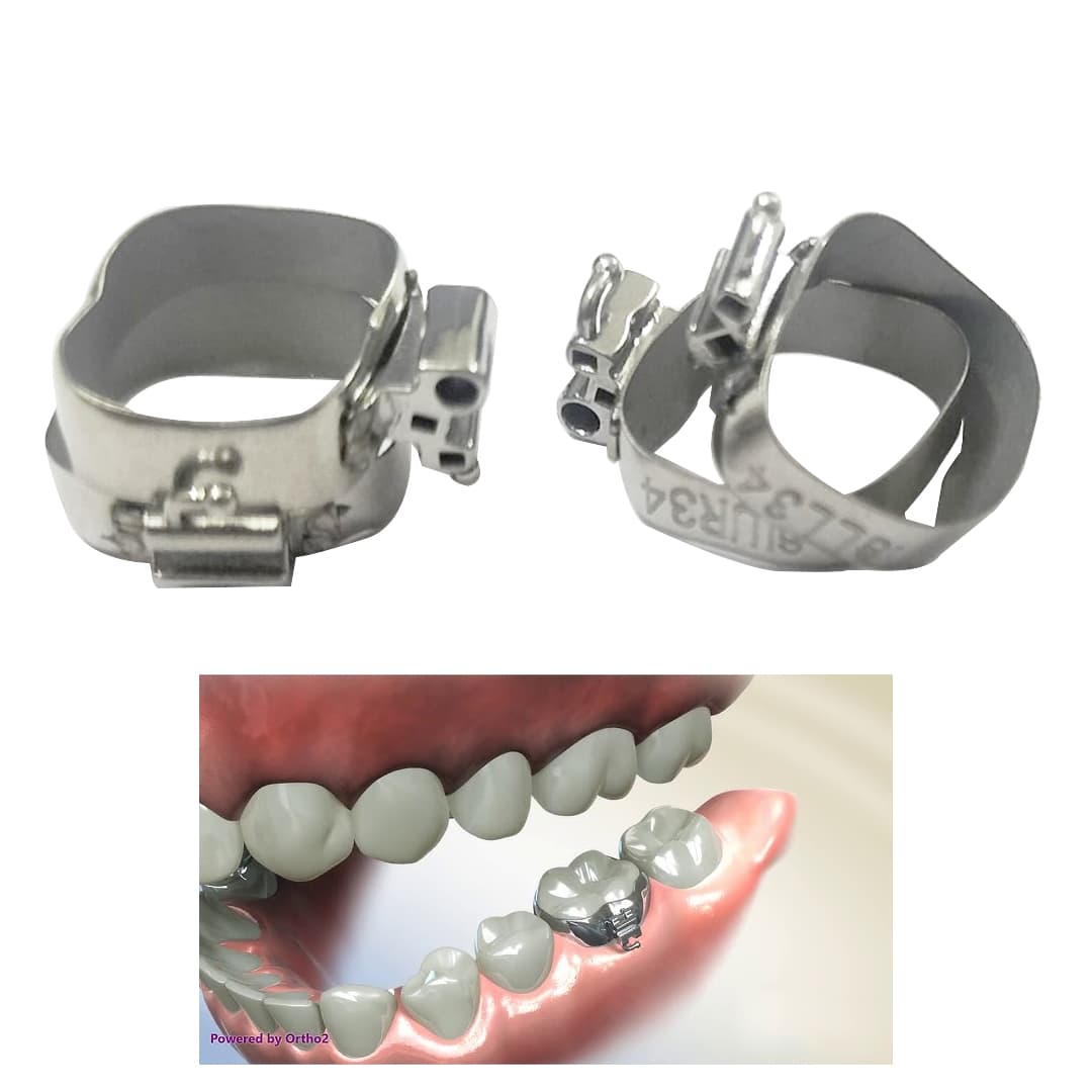 1ST MOLAR PREWELDED -MBT 0.018- U3/L2 MOLAR BANDS (PACK OF 4)